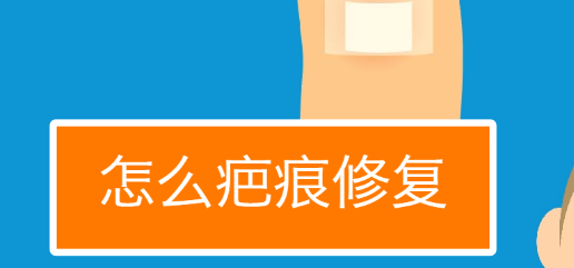 �̺��޸�